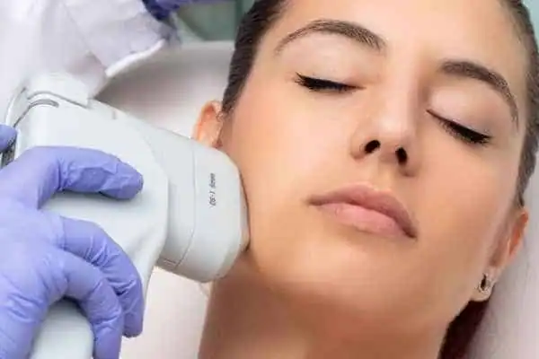 Image of woman having HIFU Devizes treatment