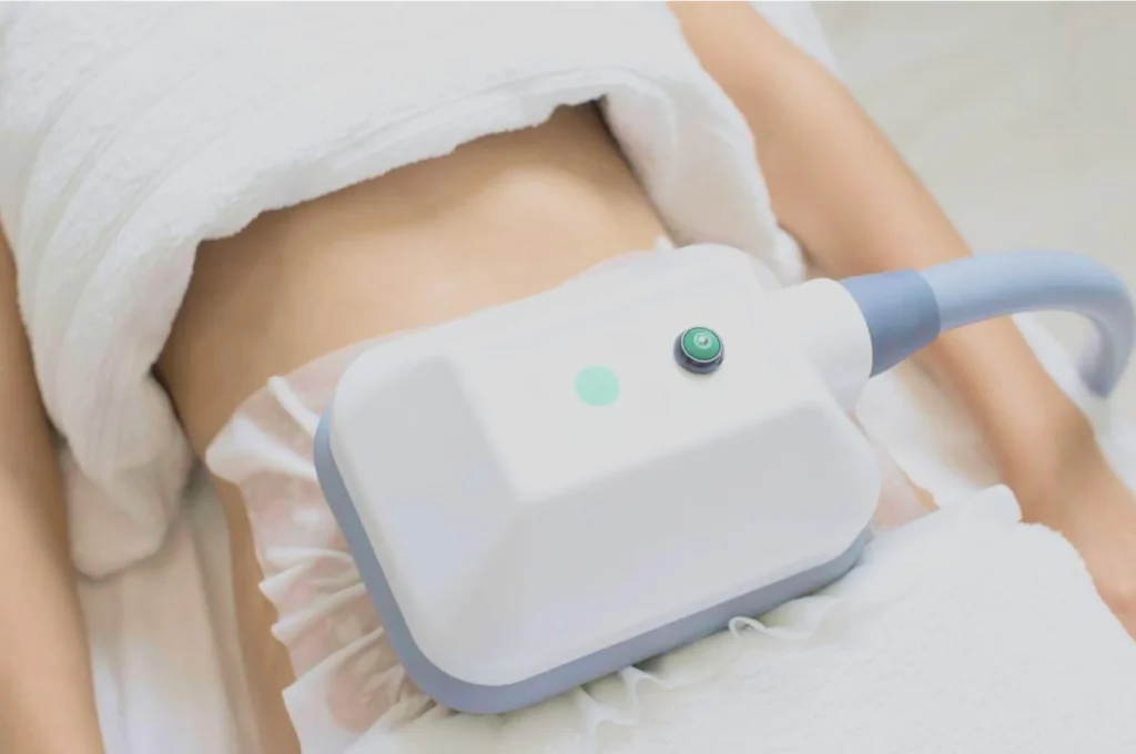 How Fat Freezing and HIFU Work Together? 3 advantages to combining Fat Freezing and HIFU Devizes