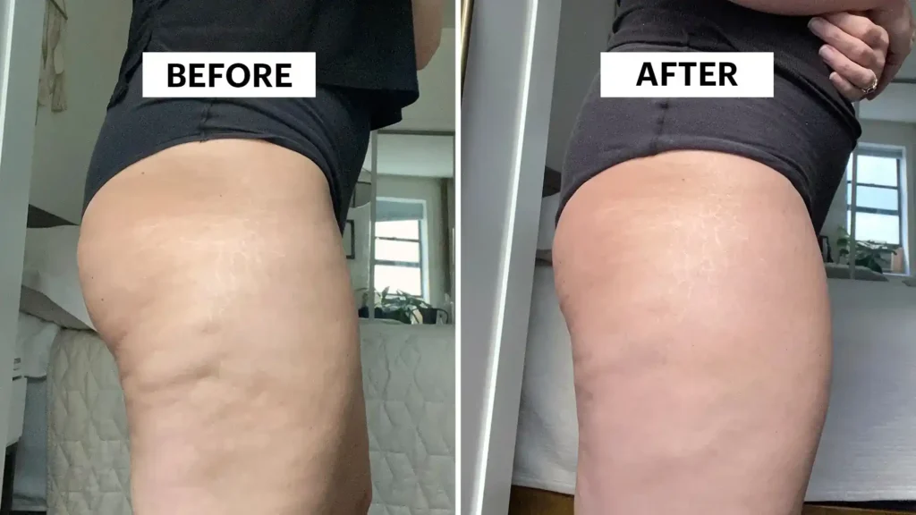Do Toning Exercise Devizes Really Tackle Cellulite?