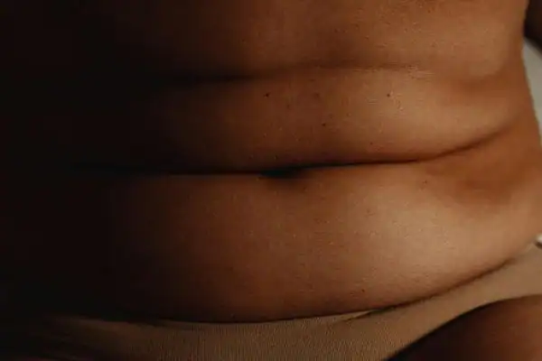 The Hidden Connection: How Stress Shapes Your Fitness and Body Composition 3 image of what stress can do on the stomach area and how Lipo 360 Devizes can help to change your body shape.