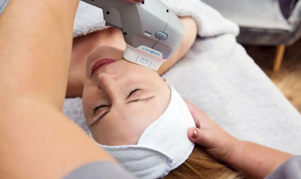 Discover the Perfect Duo: Morpheus8 and HIFU 1 Image of Morpheus8 And HIFU Devizes combined treatment